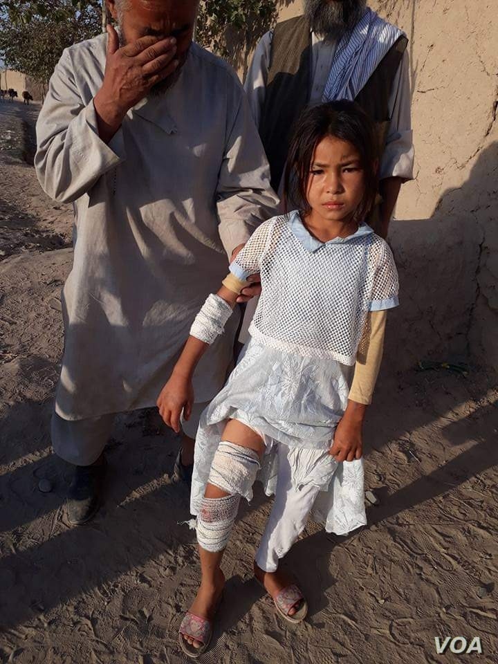 Pic 5: Masuda Ozbek, 10, was injured in the mortar attack that left her twin sister dead in Afghanistan last year. (Photo Courtesy of her father, Abdul Kareem Ozbek)
