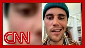 Justin Bieber says one side of his face is paralyzed