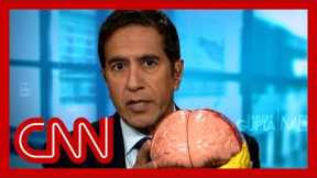 Dr. Sanjay Gupta explains how the pandemic affected teen brains