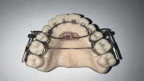 ‘AGGA’ Inventor Testifies His Dental Device Was Not Meant for TMJ or Sleep Apnea
